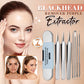 💓HOT SALE 90% OFF💥Stainless Steel Blackhead Remover Tool Kit